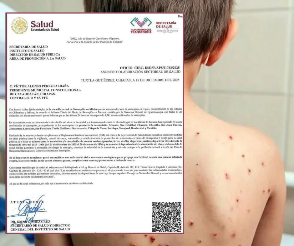 Chiapas suspende actividades públicas ante el aumento nacional de casos de sarampión